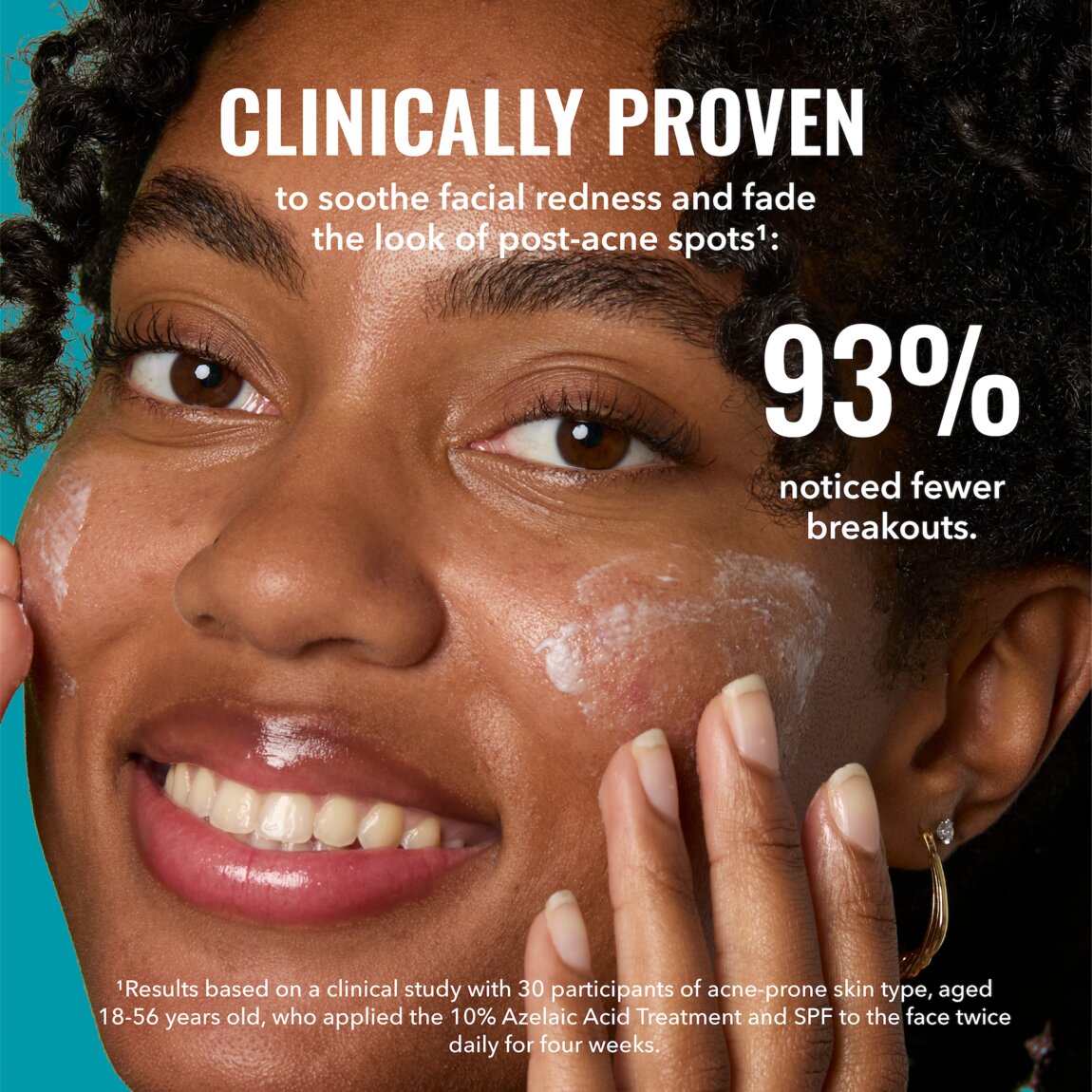 10-azelaic-acid-treatment-f3 zb_p.jpg