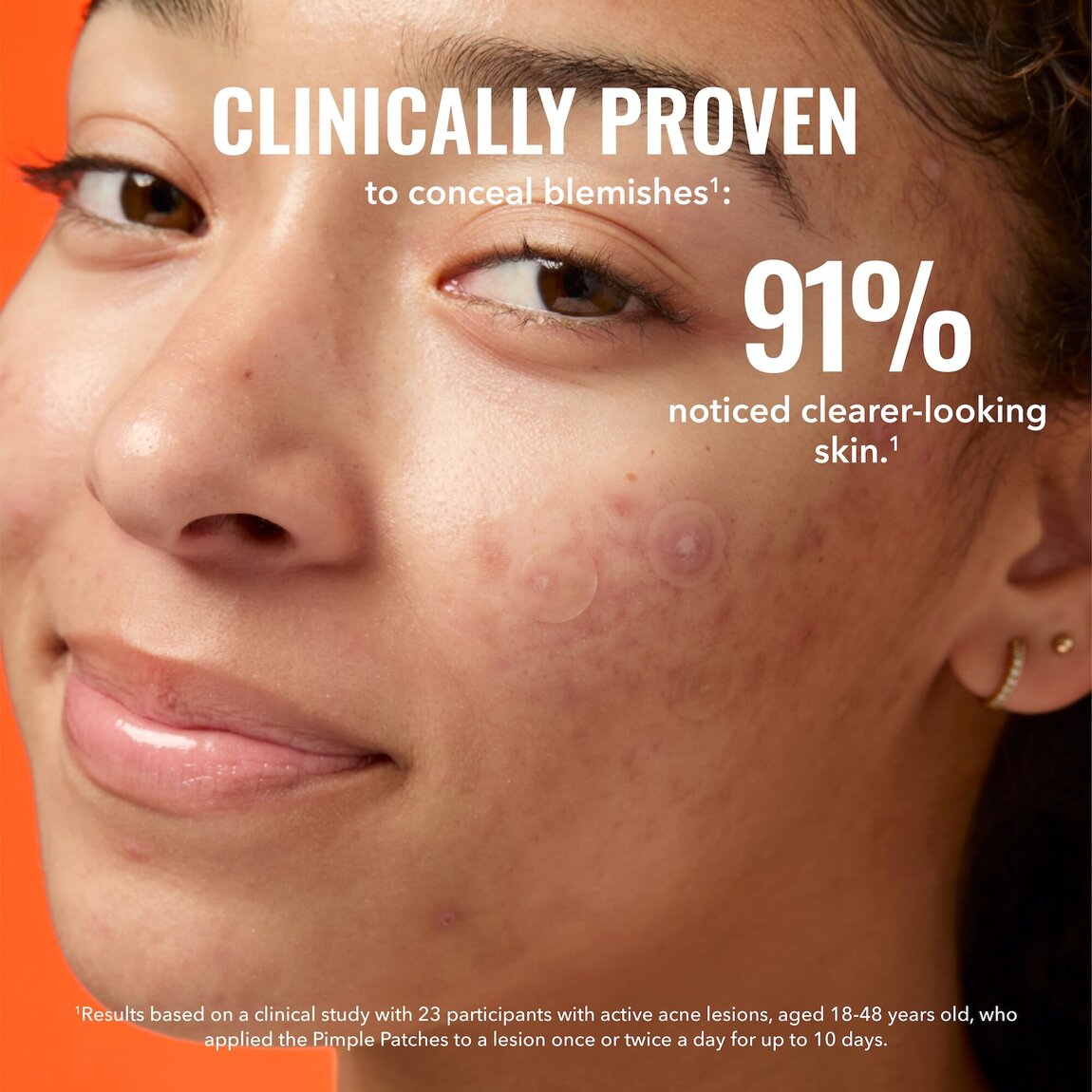 pimple-patches-y3 zb_p.jpg