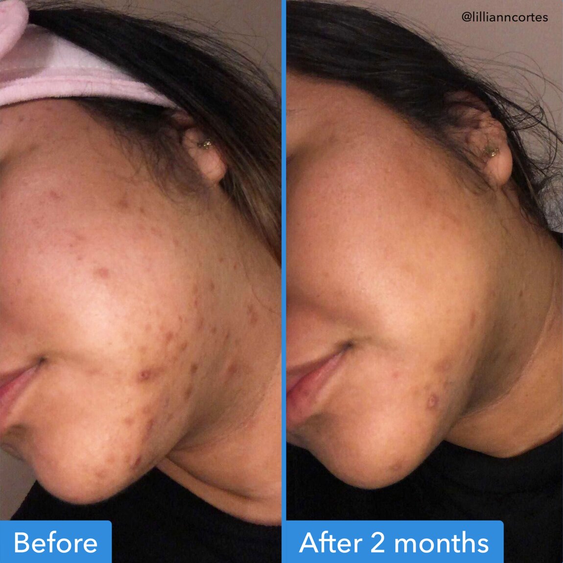 discoloration-correcting-serum-p8 zb_p.jpg
