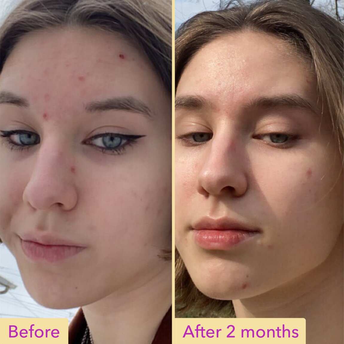 niacinamide-serum-y9 zb_p.jpg