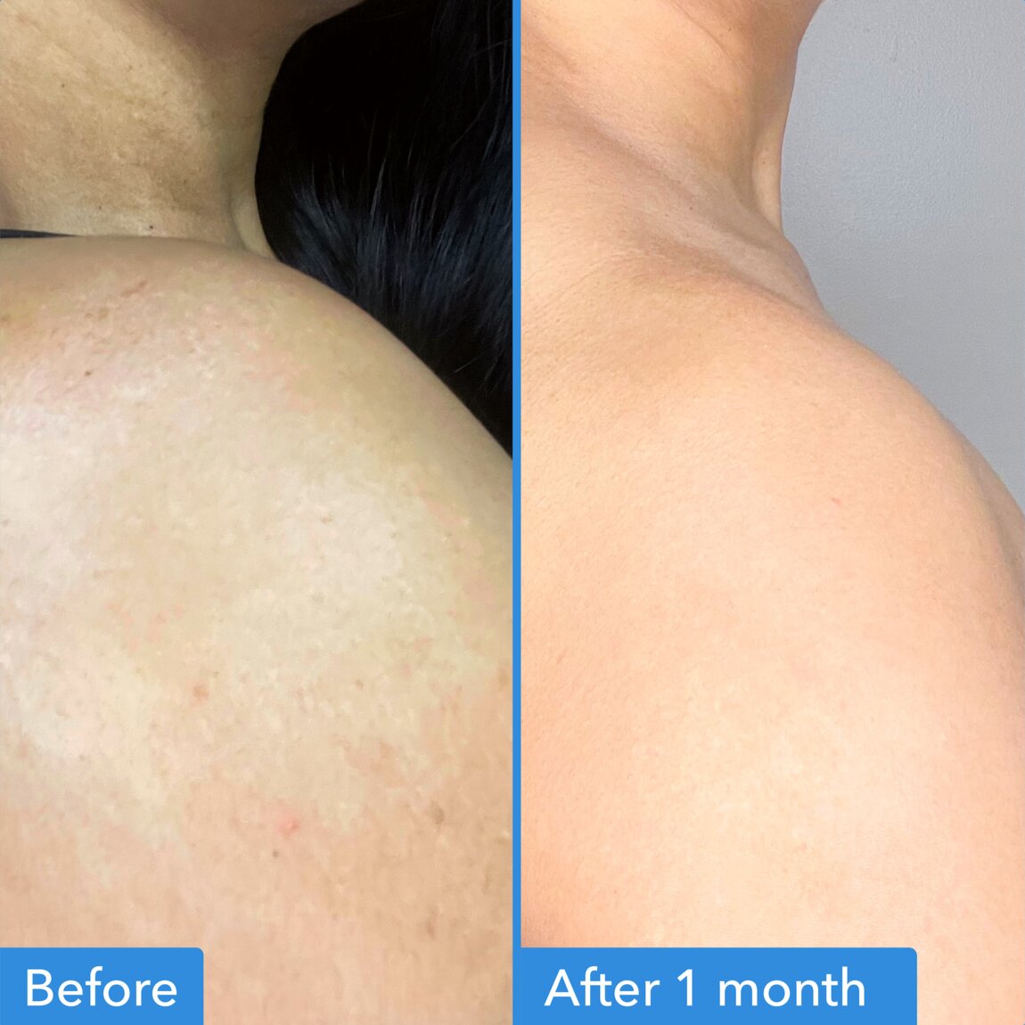 discoloration-correcting-body-treatment-o2 zb_p.jpg
