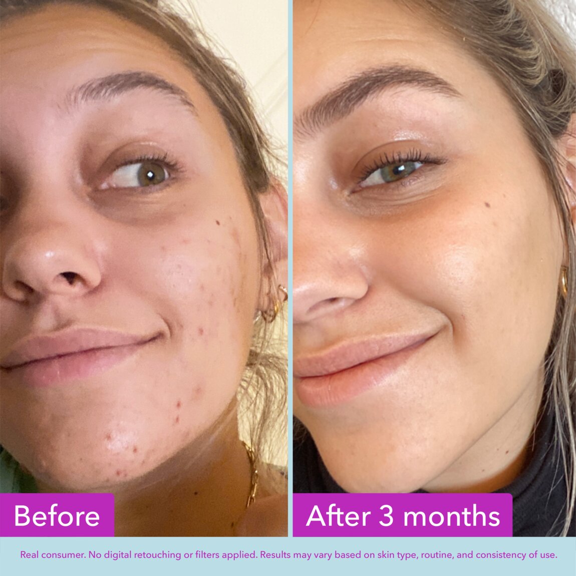 niacinamide-brightening-toner-z2 zb_p.jpg